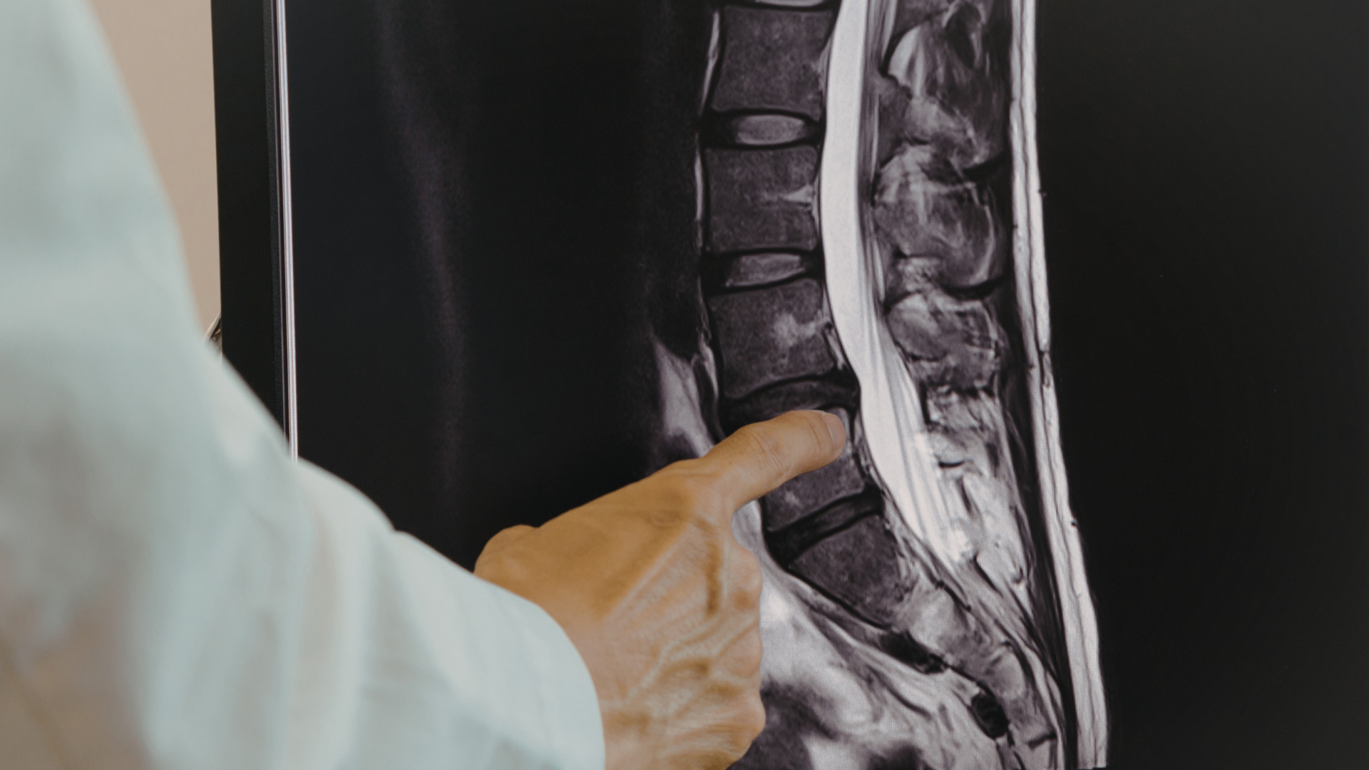 Specialist spinal cord injury rehabilitation at Ascot Rehab London